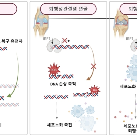 IRF1 deficiency predisposes cartilage to accumulate DNA damage and promotes osteoarthritis development