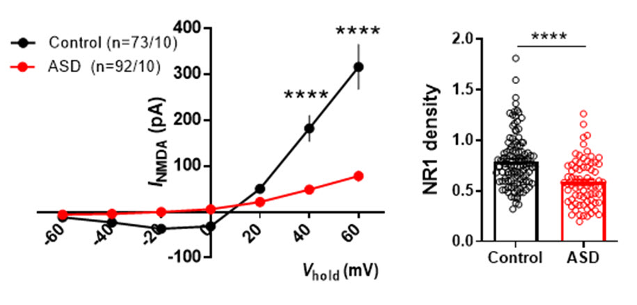 (왼쪽) 정상 신경세포에 비해 환자 유래 신경세포에서 NMDA 수용체를 통한 전류가 유의미하게 감소함을 확인하였다.<br>(오른쪽) 정상 신경세포와 환자 유래 신경세포의 신경돌기에서 NMDA 수용체 구성단백질인, NR1 의 발현을 정량적으로 분석하였다. 환자 유래 신경세포에서 유의미하게 감소한 것을 관찰하였다.