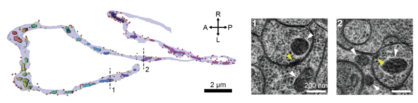 신경세포와 그 안의 미토콘드리아를 3D로 재구성한 그림.오른쪽 전자현미경 사진으로부터 미토콘드리아 (흰색 화살표), 시냅스 (노란색 화살표) 등을 구분할 수 있고 딥러닝을 활용하면 이 요소들을 자동으로 찾고 재구성할 수 있다. 그 결과 왼쪽의 사진처럼 미토콘드리아의 모양 및 분포의 구조적 특성들을 세포 내 시냅스 등 다양한 특성들과 연관지어 분석이 가능하다.