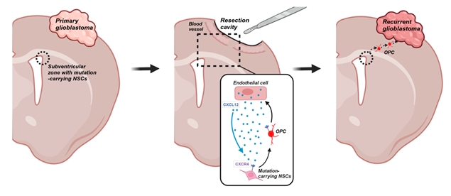 연구요약: 일차암(왼쪽)을 수술적으로 절제해도 뇌 깊은 곳의 암씨앗 신경줄기세포에 혈관내피세포가 영향을 끼쳐 이동을 촉진함(중간). 이후 신경줄기세포가 암 위치로 이동하여 재발암으로 발전함(오른쪽).