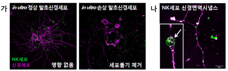 그림 1 (가) NK세포는 손상된 신경세포돌기만 선택적으로 제거함. 이것은 (나) NK세포와 신경세포의 직접 접촉에 의한 신경면역시냅스에 기인함